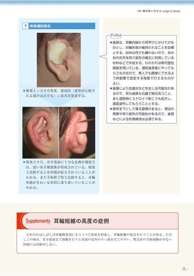 ストア 縫合後 石鹸 しみる