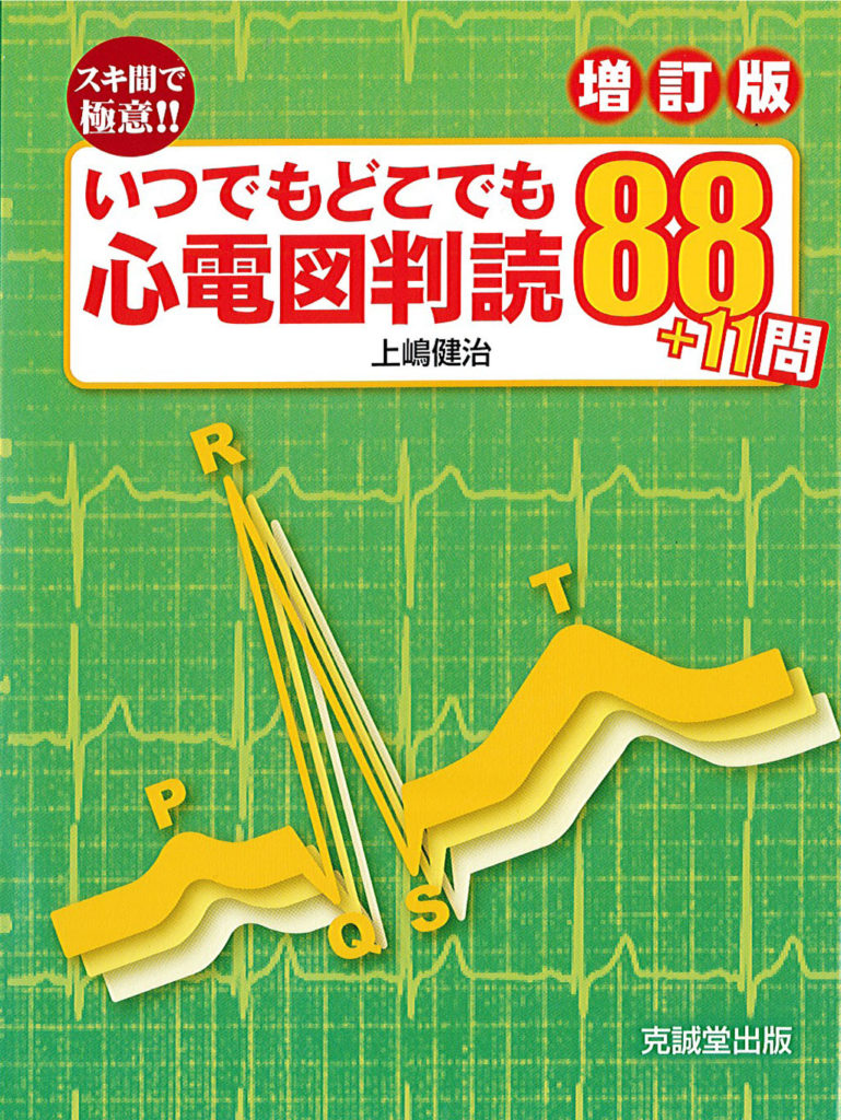 スキ間で極意!! いつでもどこでも心電図判読 88＋11問 ［増訂版］ | 克